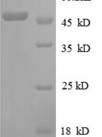 Escherichia coli 30S ribosomal protein S3 (rpsC) Recombinant Protein - BioCrest Sci