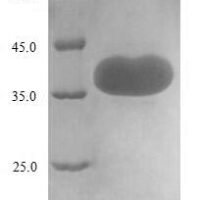 Human CD44 antigen (CD44), partial Recombinant Protein, N-His-SUMO, aa 21–220 - BioCrest Sci