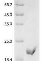 Junin arenavirus RING finger protein Z (Z) Recombinant Protein - BioCrest Sci
