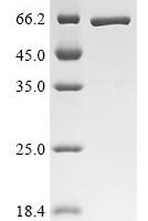 Human Interferon-induced protein with tetratricopeptide repeats 1(IFIT1) Recombinant Protein - BioCrest Sci