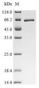 Human Interferon-induced protein with tetratricopeptide repeats 1(IFIT1) Recombinant Protein, Homo sapiens (Human), E.coli, C-terminal 6xHis-tagged, 62.3 kDa, purity >≥ 95% as determined by SDS-PAGE.