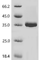 Avian sarcoma virus Tyrosine-protein kinase transforming protein Src (V-SRC), partial Recombinant Protein, N-10His/C-Myc - BioCrest Sci