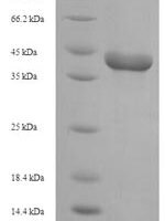 Rhizomucor miehei Lipase (D250G) Recombinant Protein - BioCrest Sci