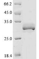 Rat Asialoglycoprotein receptor 1 (Asgr1), partial Recombinant Protein - BioCrest Sci
