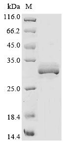 Rat Asialoglycoprotein receptor 1 (Asgr1), partial Recombinant Protein, Rattus norvegicus (Rat), Baculovirus, N-terminal 10xHis-tagged and C-terminal Myc-tagged, 29.9 kDa, purity >≥ 85% as determined by SDS-PAGE.