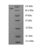 Human Phenylalanine--tRNA ligase alpha subunit (FARSA) Recombinant Protein - BioCrest Sci