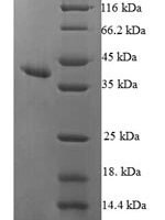 Human Ribonuclease UK114 (HRSP12) Recombinant Protein - BioCrest Sci