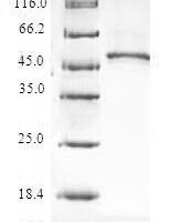 Human 60S ribosomal protein L9 (RPL9) Recombinant Protein - BioCrest Sci