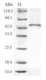 Human 60S ribosomal protein L9 (RPL9) Recombinant Protein, Homo sapiens (Human), E.coli, N-terminal GST-tagged, 48.9 kDa, purity >≥ 90% as determined by SDS-PAGE.