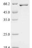 Mycobacterium tuberculosis Uncharacterized protein Rv0647c Recombinant Protein - BioCrest Sci