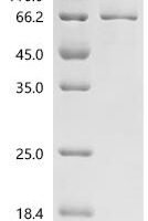 Human Roundabout homolog 3 (ROBO3), partial Recombinant Protein, C-10His - BioCrest Sci