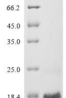 Mouse Metallothionein-3 (Mt3) Recombinant Protein - BioCrest Sci