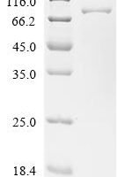 Yarrowia lipolytica ATP citrate synthase Recombinant Protein, C-His, aa 1–650 - BioCrest Sci