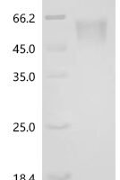 Human Ciliary neurotrophic factor receptor subunit alpha (CNTFR) Recombinant Protein - BioCrest Sci