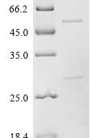 Mouse Protein unc-13 homolog A (Unc13a), partial Recombinant Protein - BioCrest Sci