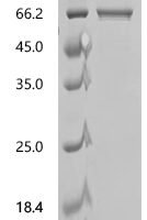 Mycolicibacterium smegmatis 3-oxosteroid 1-dehydrogenase (ksdD) Recombinant Protein, C-His, aa 1–569, Purity ≥90% - BioCrest Sci