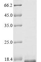 Leishmania donovani Transitional endoplasmic reticulum ATPase,putative (LDBPK_361420), partial Recombinant Protein - BioCrest Sci