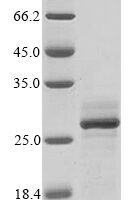 Lassa virus Pre-glycoprotein polyprotein GP complex (GPC), partial Recombinant Protein, N-10His/C-Myc - BioCrest Sci
