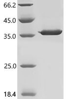 Human papillomavirus 11 Protein E6 (E6) Recombinant Protein, N-His-SUMO - BioCrest Sci