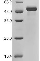 Human Interleukin-1 beta (IL1B) Recombinant Protein - BioCrest Sci