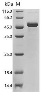 Human Interleukin-1 beta (IL1B) Recombinant Protein, Homo sapiens (Human), Mammalian cell, N-terminal hFc1-tagged, 43.4 kDa, purity >≥ 90% as determined by SDS-PAGE.