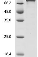 Human Phosphoenolpyruvate carboxykinase [GTP], mitochondrial (PCK2) Recombinant Protein - BioCrest Sci
