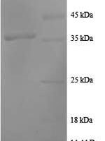 Human C-C motif chemokine 20 (CCL20), partial Recombinant Protein, N-GST - BioCrest Sci