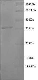 Human C-C motif chemokine 20 (CCL20), partial Recombinant Protein, N-GST, Homo sapiens (Human), E.coli, N-terminal GST-tagged, 34.9 kDa, purity >≥ 90% as determined by SDS-PAGE.