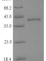 Dog Cathepsin K (CTSK) Recombinant Protein - BioCrest Sci
