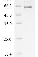 Human Lysyl oxidase homolog 1 (LOXL1) Recombinant Protein, C-His - BioCrest Sci