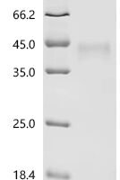 Human Transmembrane protein 158 (TMEM158), partial Recombinant Protein - BioCrest Sci