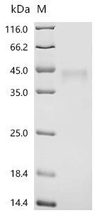 Human Transmembrane protein 158 (TMEM158), partial Recombinant Protein, Homo sapiens (Human), Mammalian cell, C-terminal 10xHis-tagged, 23.6 kDa, purity >≥ 95% as determined by SDS-PAGE.