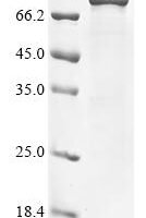 Escherichia coli Bifunctional (p)ppGpp synthase/hydrolase SpoT (spoT) Recombinant Protein - BioCrest Sci