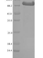 Mouse Beta-adrenergic receptor kinase 1 (Grk2) Recombinant Protein, N-His-SUMO - BioCrest Sci