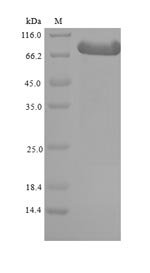 Mouse Beta-adrenergic receptor kinase 1 (Grk2) Recombinant Protein, N-His-SUMO, Mus musculus (Mouse), E.coli, N-terminal 6xHis-SUMO-tagged, 95.6 kDa, purity >≥ 90% as determined by SDS-PAGE.