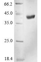 Human HLA class I histocompatibility antigen, A alpha chain (HLA-A), partial Recombinant Protein - BioCrest Sci