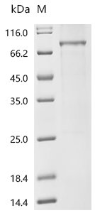Mouse Basic helix-loop-helix ARNT-like protein 1 (Bmal1) Recombinant Protein, Mus musculus (Mouse), E.coli, C-terminal Flag-tagged, 70.6 kDa, purity >≥ 85% as determined by SDS-PAGE.