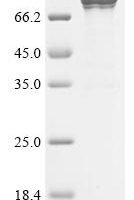 Measles virus Fusion glycoprotein F0 (F), partial, Biotinylated Recombinant Protein - BioCrest Sci
