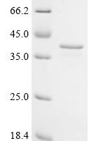Human C-1-tetrahydrofolate synthase, cytoplasmic (MTHFD1), partial Recombinant Protein - BioCrest Sci