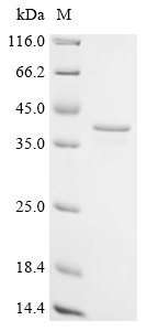 Human C-1-tetrahydrofolate synthase, cytoplasmic (MTHFD1), partial Recombinant Protein, Homo sapiens (Human), E.coli, N-terminal 10xHis-tagged and C-terminal Myc-tagged, 38.8 kDa, purity >≥ 85% as determined by SDS-PAGE.