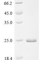 Porcine reproductive and respiratory syndrome virus Nucleoprotein (N) Recombinant Protein, C-His, aa 1–123 - BioCrest Sci