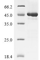Human Interleukin-17F (IL17F) Recombinant Protein, N-10His-GST/C-Myc - BioCrest Sci