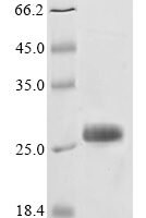 Ixodes scapularis Tick receptor for ospA (TROSPA) Recombinant Protein - BioCrest Sci