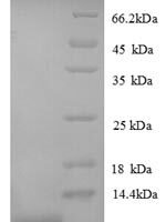 Mouse Growth-regulated alpha protein (Cxcl1), partial Recombinant Protein - BioCrest Sci