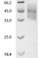 Rat Advanced glycosylation end product-specific receptor (Ager), partial Recombinant Protein - BioCrest Sci