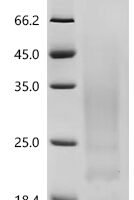 Human Interleukin-13 (IL13) Recombinant Protein, C-His - BioCrest Sci