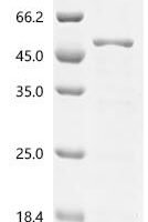 Human Paraneoplastic antigen Ma2 (PNMA2), partial Recombinant Protein, C-His, aa 2–361, E.coli - BioCrest Sci