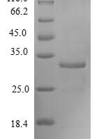 Human Forkhead box protein M1 (FOxM1), partial Recombinant Protein - BioCrest Sci