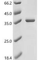 Human DNA-binding protein inhibitor ID-3 (ID3) Recombinant Protein - BioCrest Sci