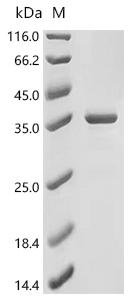 Human DNA-binding protein inhibitor ID-3 (ID3) Recombinant Protein, Homo sapiens (Human), E.coli, N-terminal 6xHis-SUMO-tagged, 31.2 kDa, purity >≥ 85% as determined by SDS-PAGE.